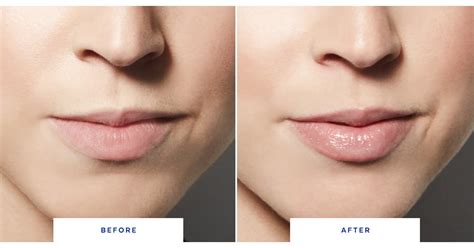 dior lip plumper before and after